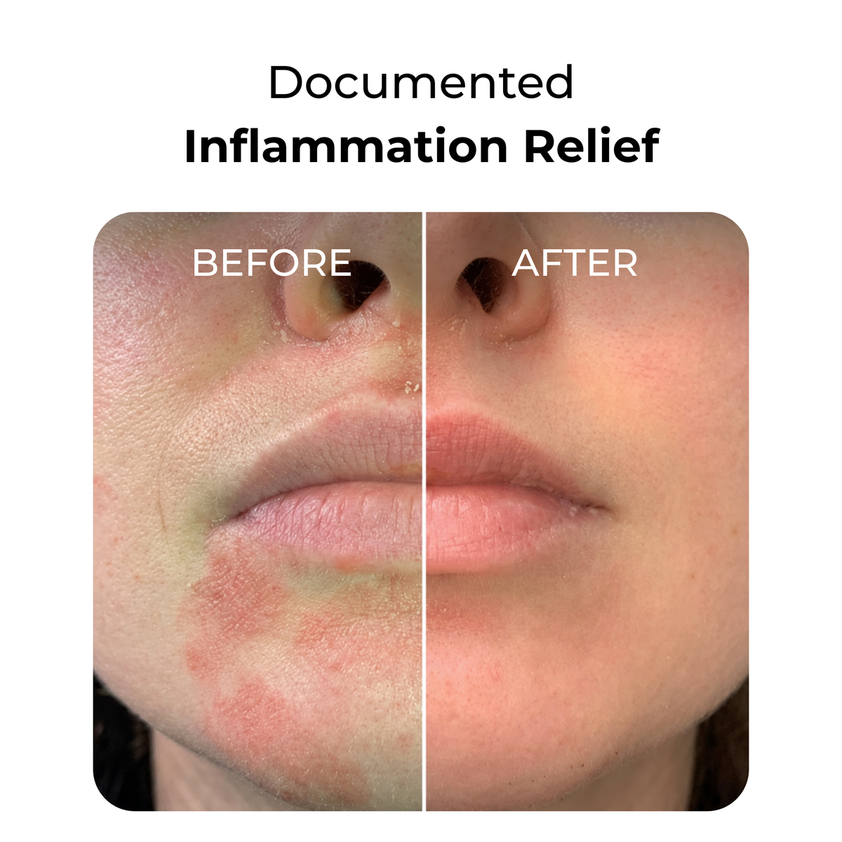 LED Face & Neck Light Therapy Mask for Wrinkles
