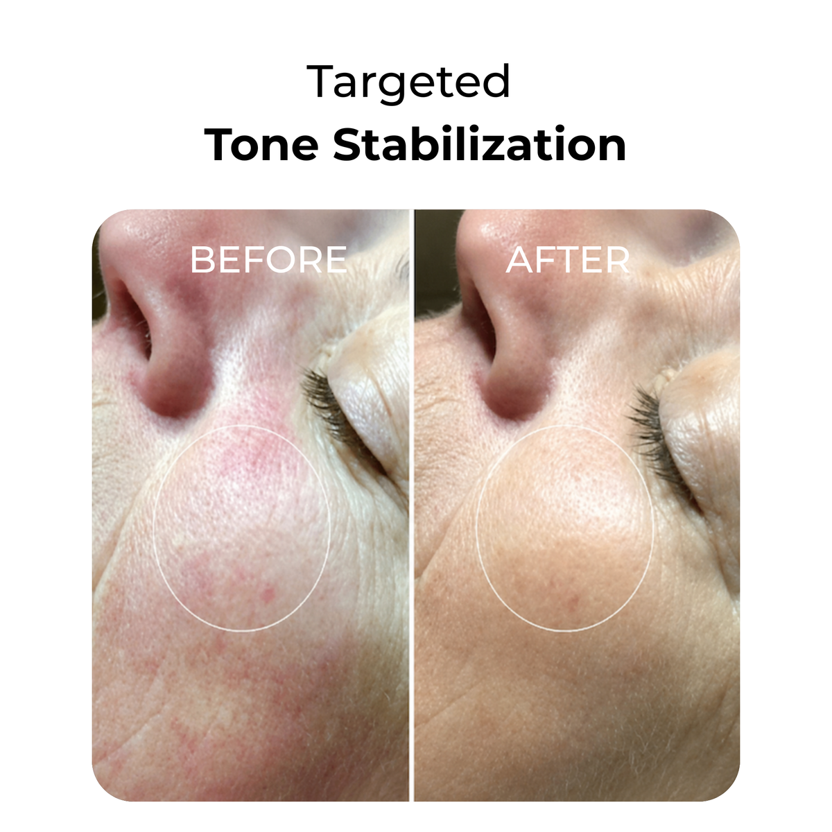 LED Face & Neck Light Therapy Mask for Wrinkles